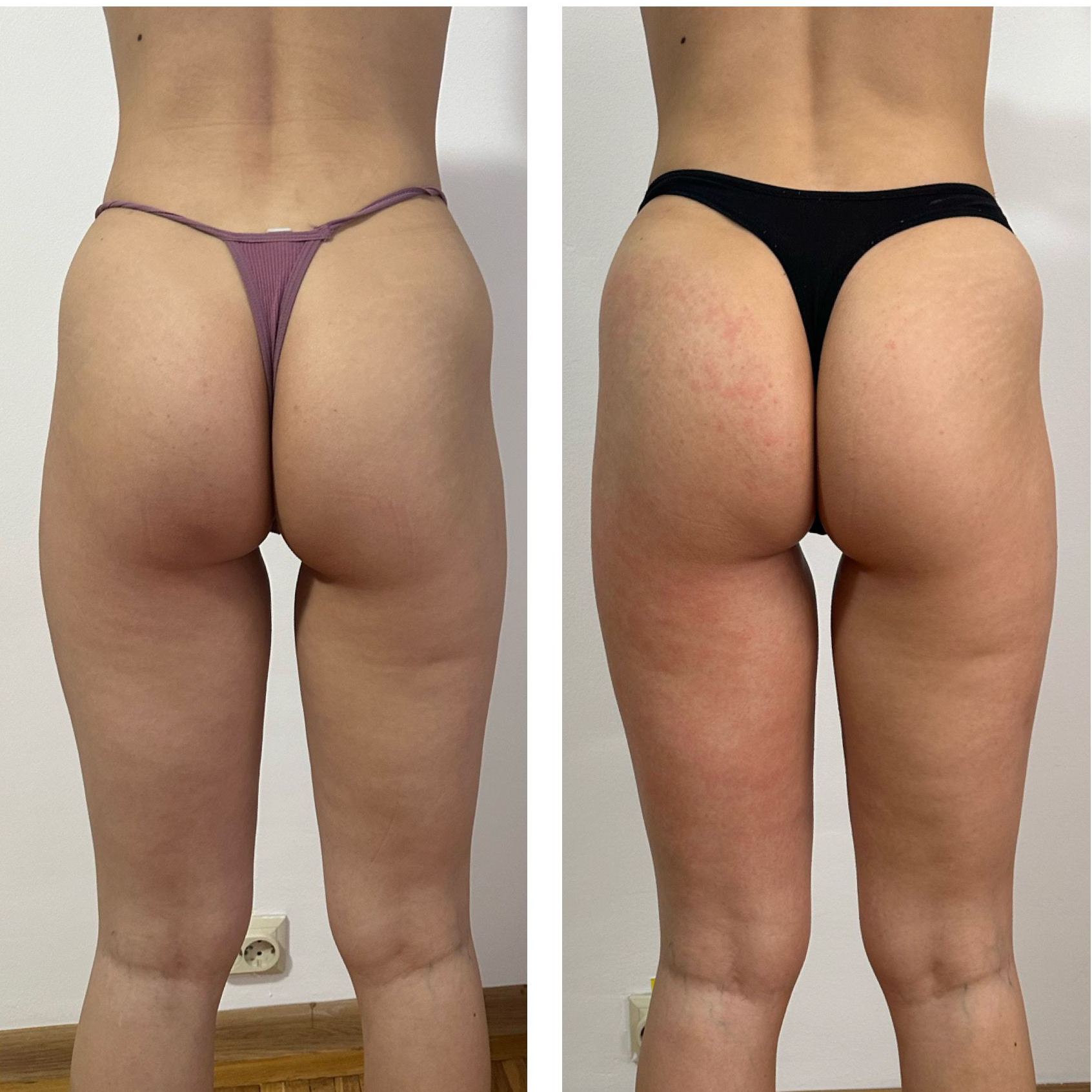 Vacuum – fese si coapse